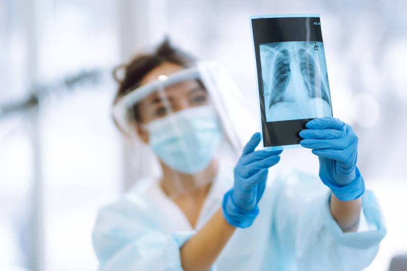 Imagem de Combate à Tuberculose