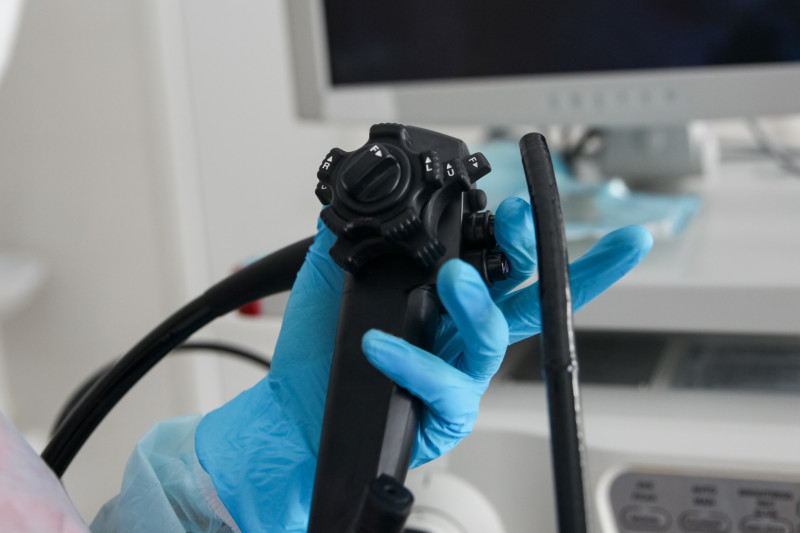 Imagem de Endoscopia com Biópsia