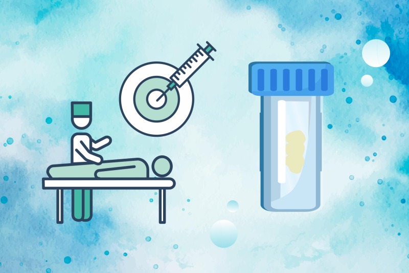 Imagem de Armazenamento Correto de Biópsias