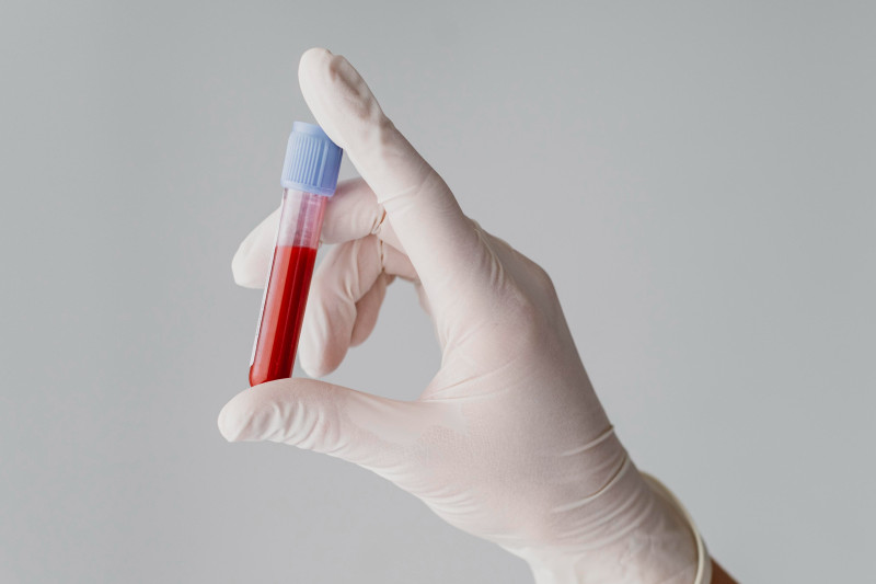 Imagem de 6 Principais Causas da Anemia