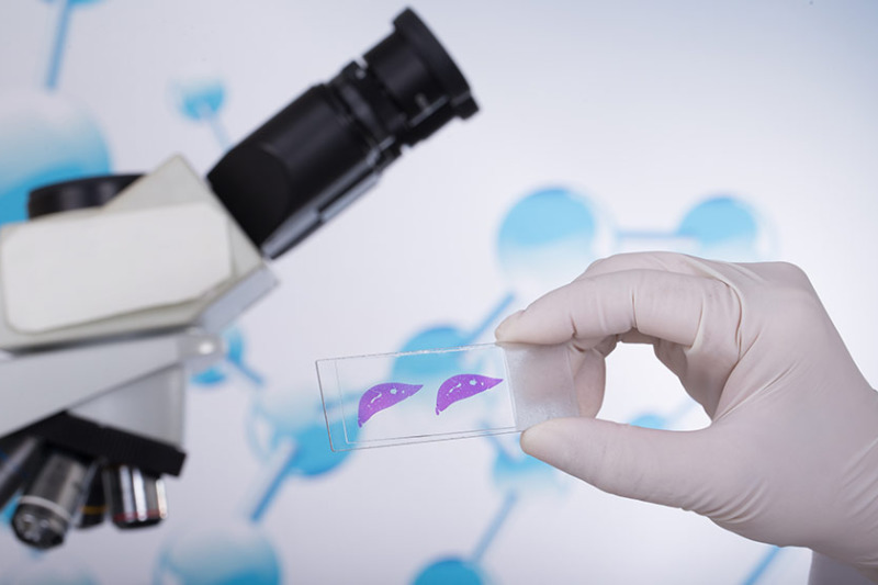 Imagem de Quais Doenças Podem ser Diagnosticadas por Biópsia