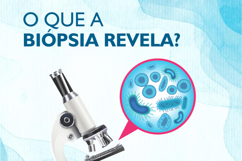 Imagem de O que a Biópsia Revela?