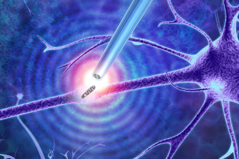 Imagem de As Biópsias Auxiliam no Diagnóstico de Diversas Doenças