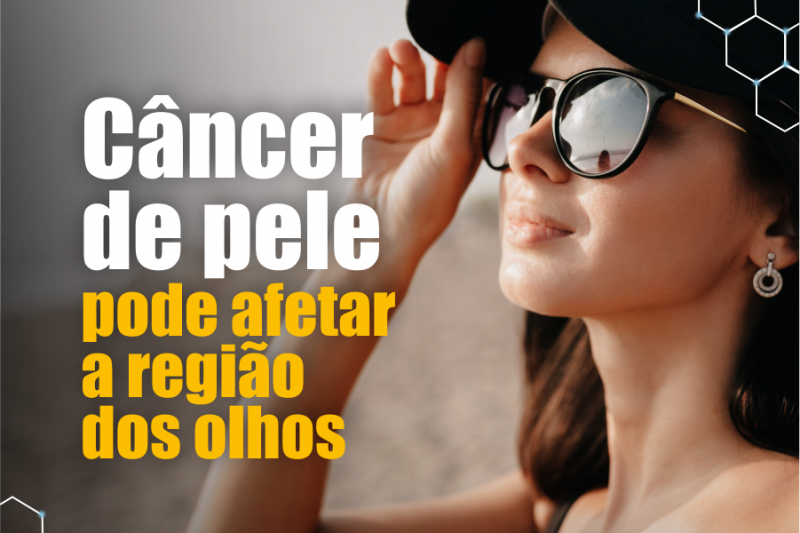 Imagem de Câncer na Região dos Olhos