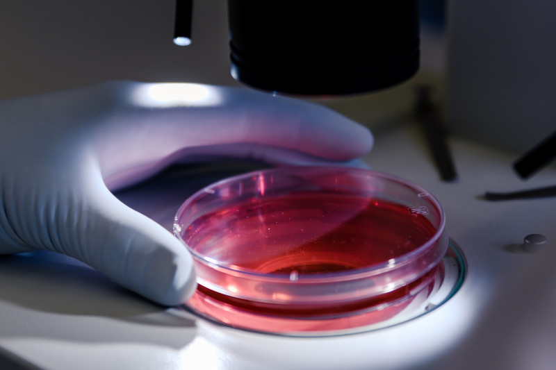 Imagem de Leucemia | Fatores de Risco e Diagnóstico