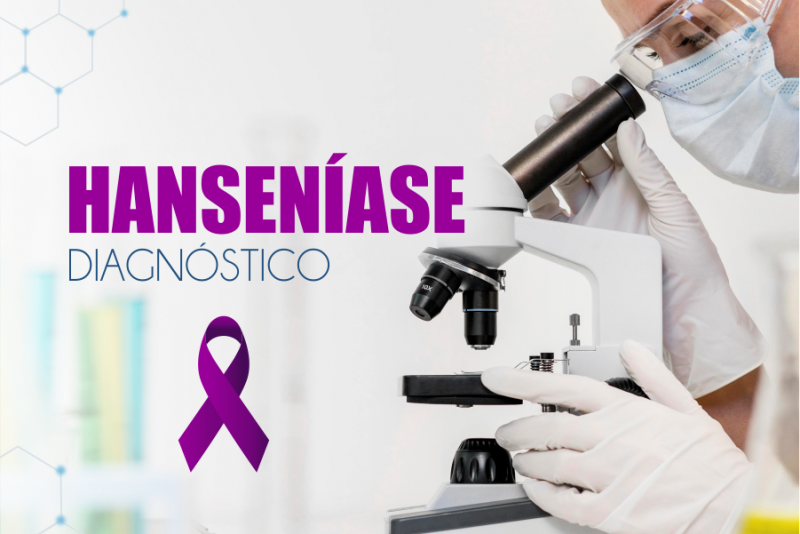 Quando suspeitar do diagnóstico de hanseníase na prática clínica? - Sanar  Medicina