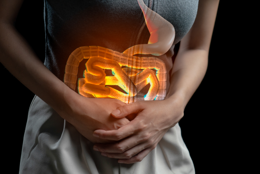 Imagem de Doença Inflamatória Intestinal 