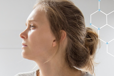 Imagem de Hanseníase