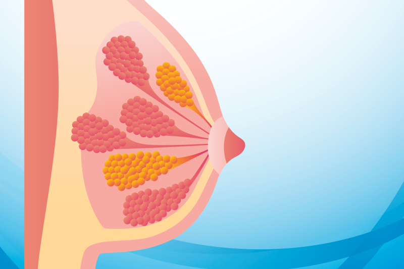 Imagem de Alterações Fibrocísticas Mamárias