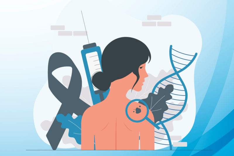 Imagem de Melanoma | Agressivo e Letal