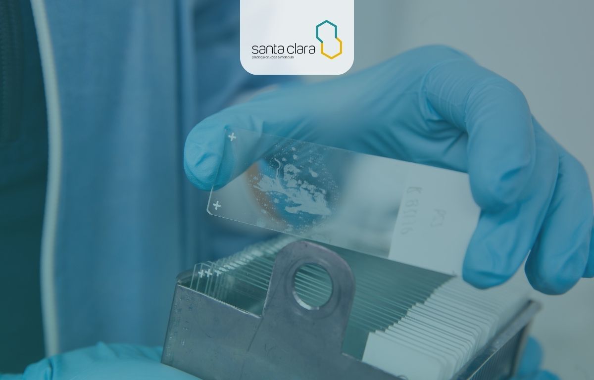 Icone de Imuno-histoquímica