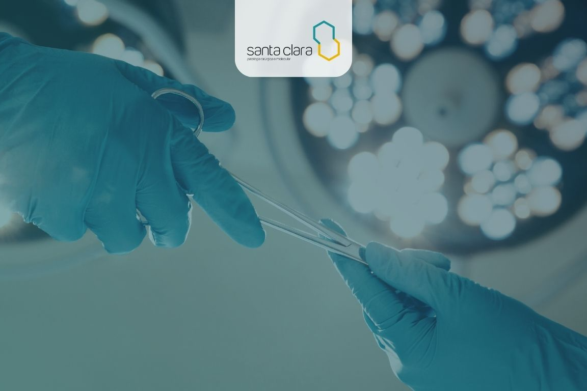 Background de Biópsias Cirúrgicas Simples