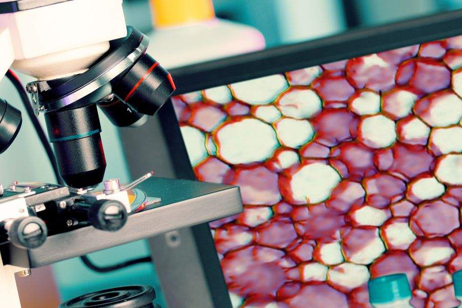 Background de Citologia oncótica de líquidos cavitários e escarro