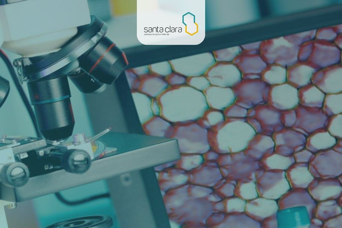 Background de Citologia oncótica de líquidos cavitários e escarro