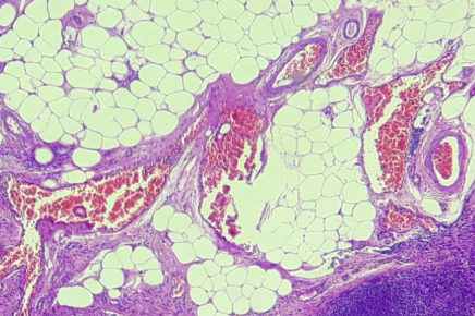 Imagem de Biópsia de Congelação (Pré-Operatória)
