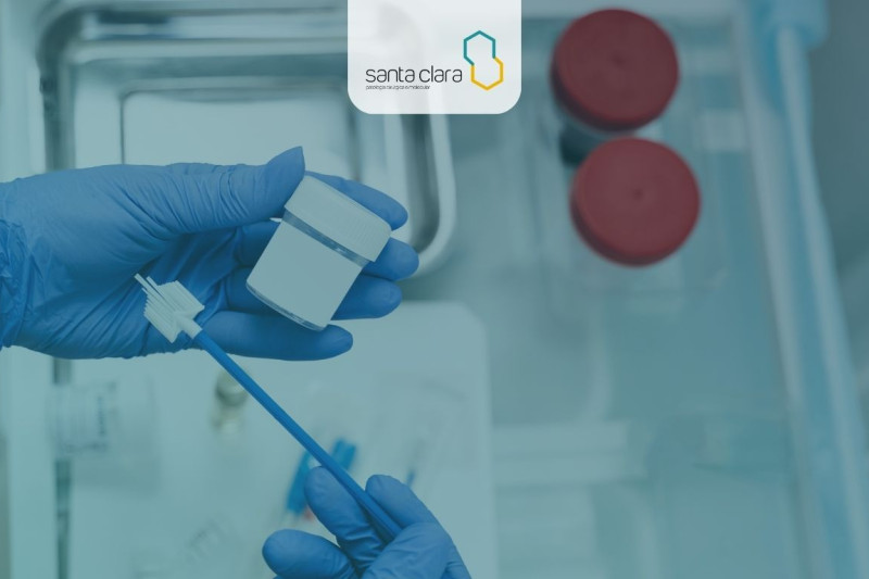 Imagem de Citologia Cérvico-Vaginal - Papanicolau (Convencional e em Meio Líquido)