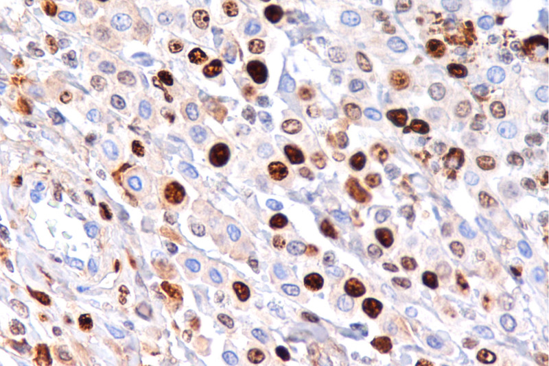 Imagem de Imunohistoquímica