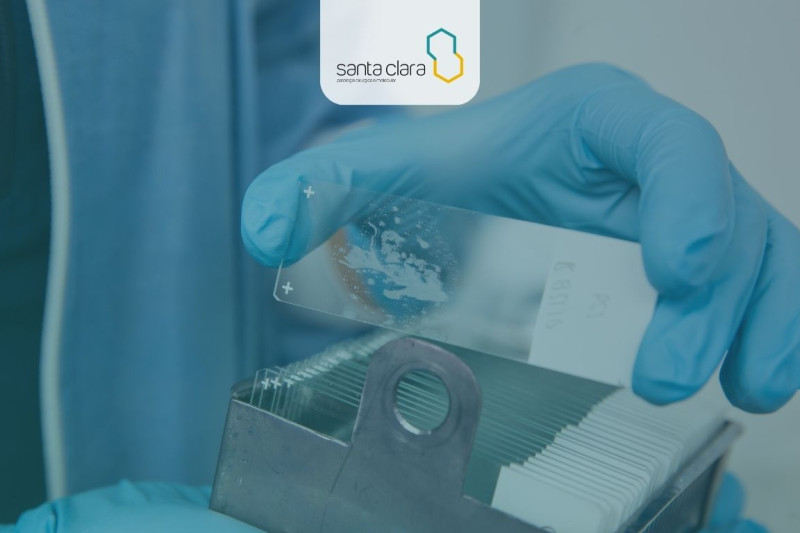 Imagem de Imunohistoquímica