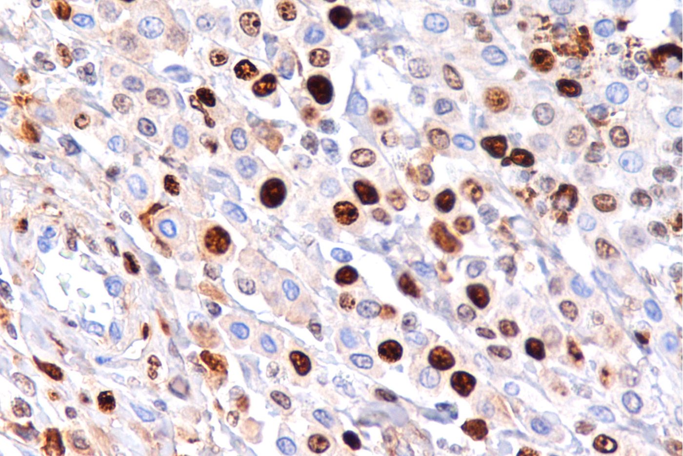 Background de Imunohistoquímica