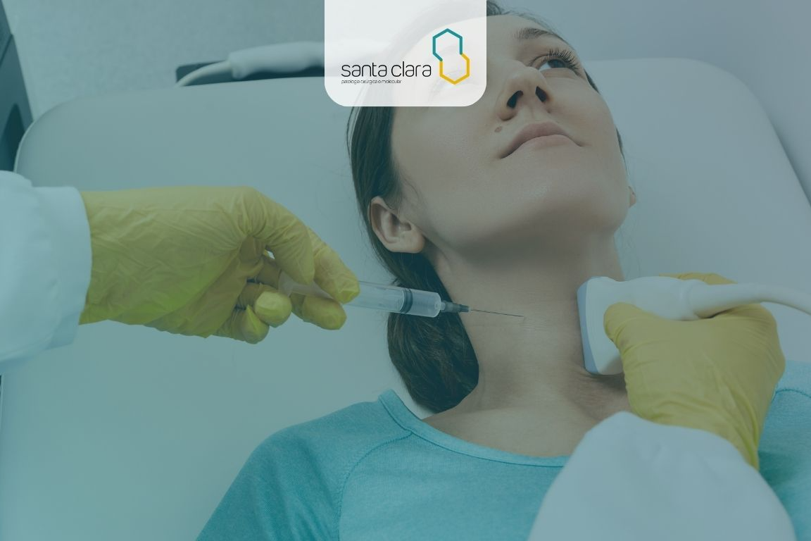 Background de Punção aspirativa por agulha fina (PAAF)